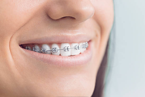 Trusted Bement, IL  Holistic Dental Services Experts